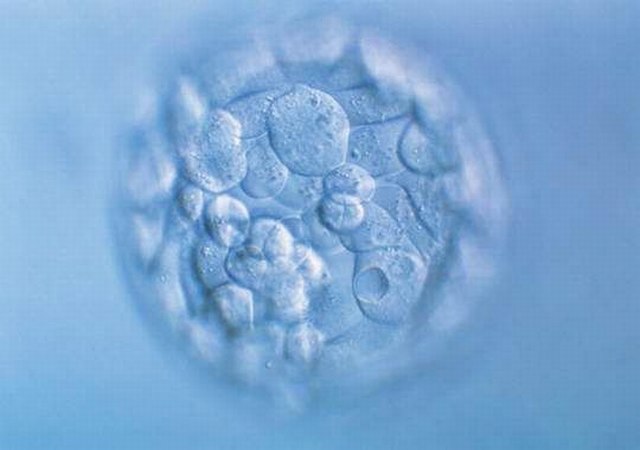 正常卵母细胞的样子以及可能发现变化是什么？
