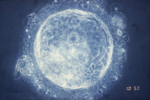 理解试管婴儿胚胎发育：从微小的开始到伟大的梦想