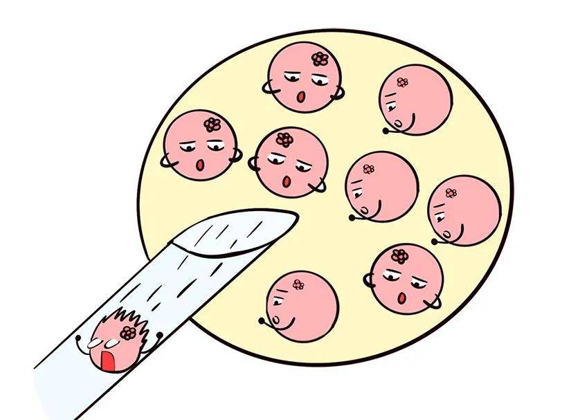 试管婴儿取卵过程