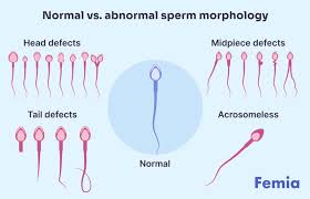 精子畸形率高 三代试管