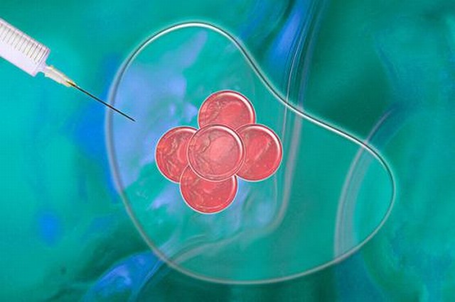 影响体外受精（IVF）成功率的因素有哪些？