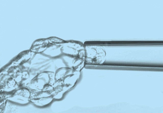 PGT-A技术对IVF成功率的机制解析与临床价值