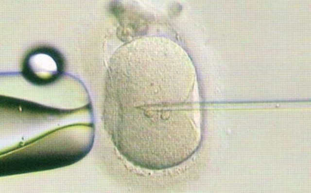 针对40岁以上女性的治疗方案，根据个人医疗史和生殖潜力而定：