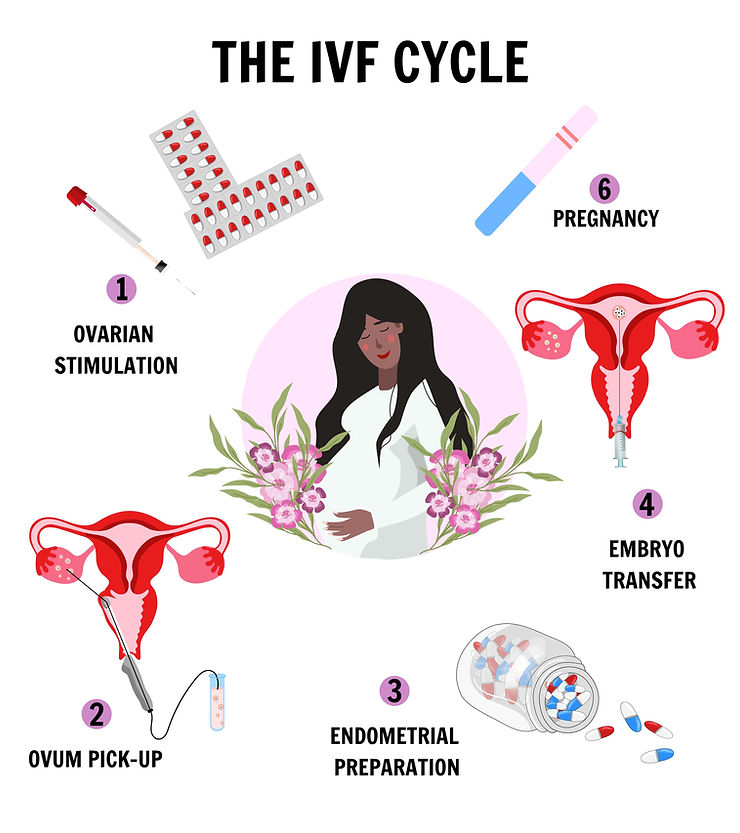 什么是体外受精(IVF)治疗?