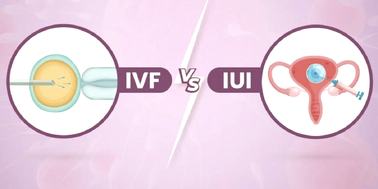 IUI与IVF主要区别是什么?