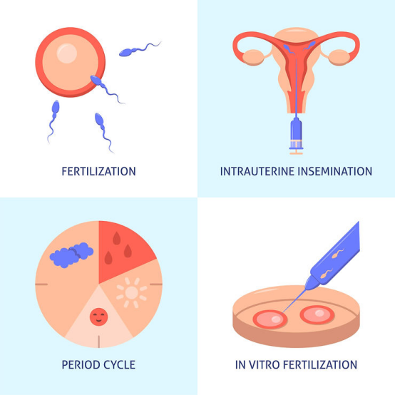 IUI 与 IVF：究竟该如何选择?