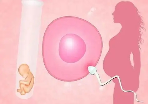 卵子捐赠的体验是怎样的?常见问题有哪些?