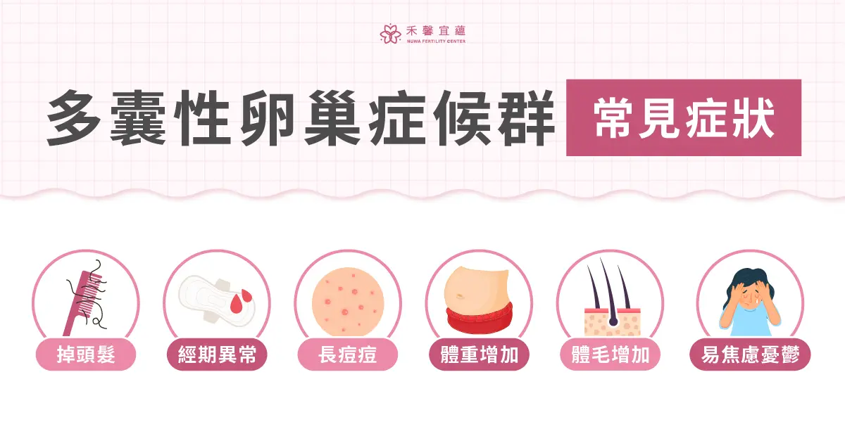 多囊卵巢综合征 三代试管