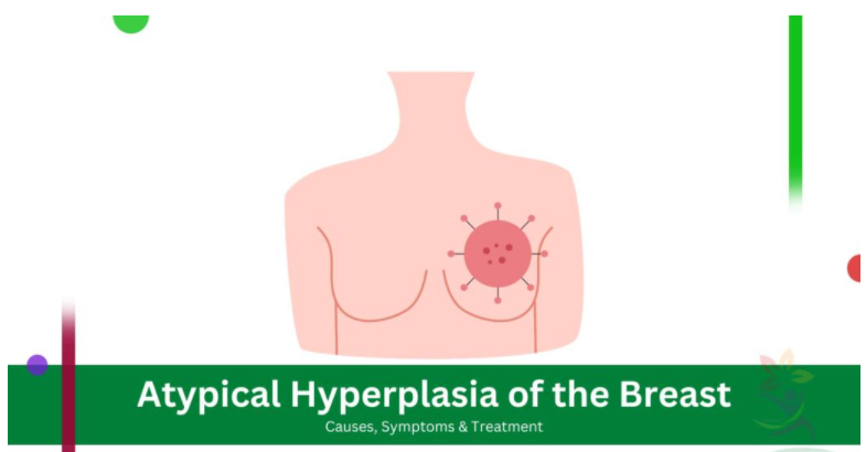 乳腺增生 三代试管