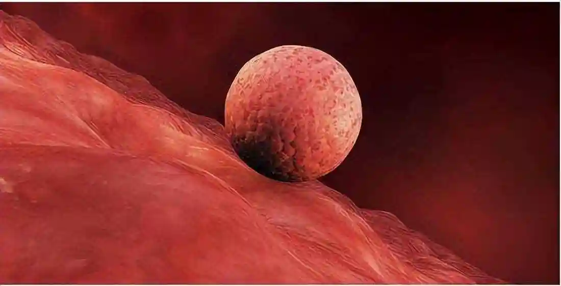 囊胚移植后没有感觉