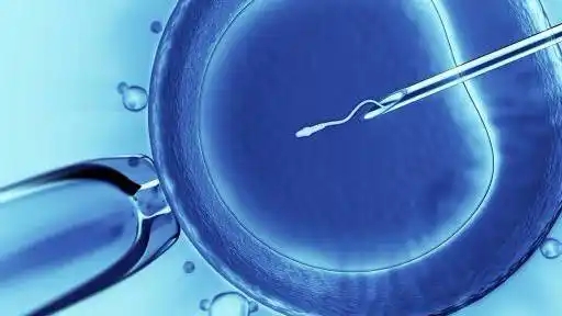 ICSI 治疗的作用和常见问题有哪些?