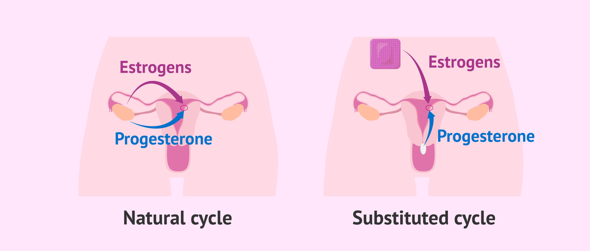 胚胎移植时间 试管婴儿