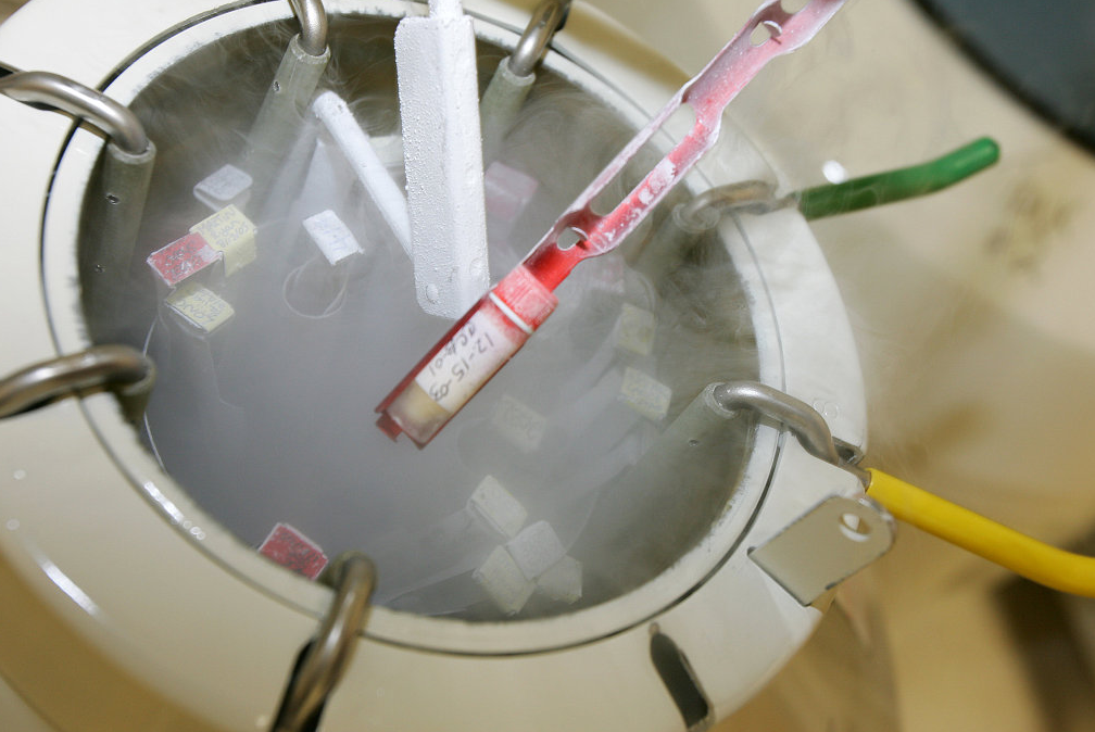 什么是冷冻卵子?为什么要考虑冷冻卵子?