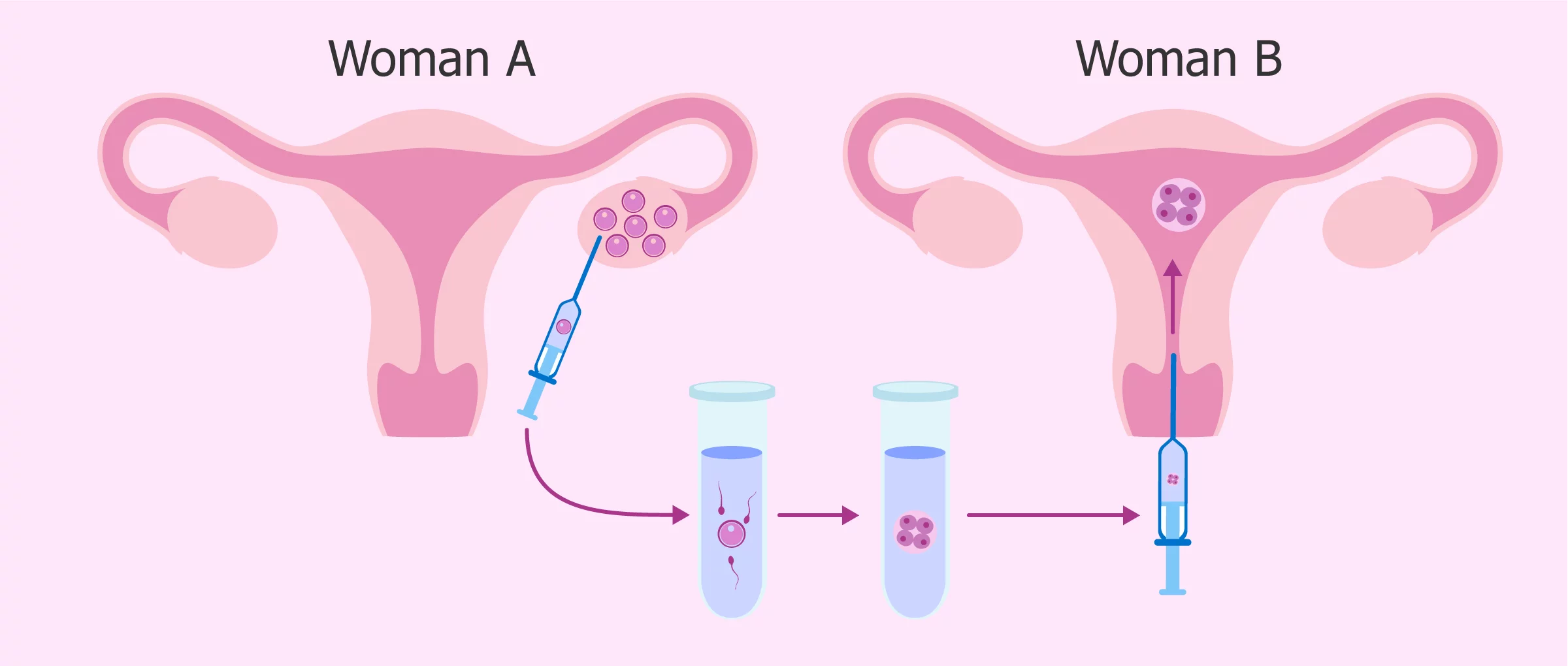 女同试管 les试管