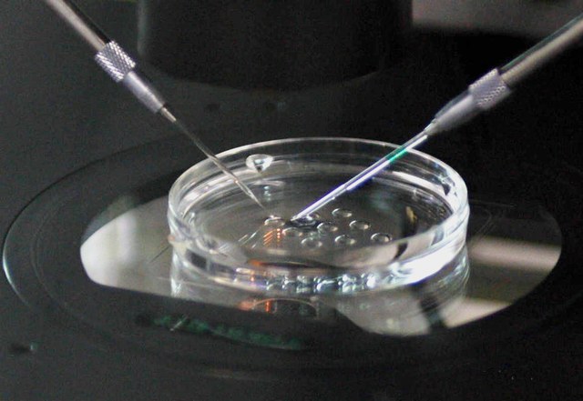 试管婴儿PGS与PGD的区别是什么?