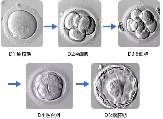 试管婴儿专家如何解读胚胎分级表？
