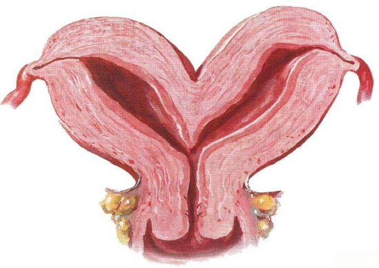 双角子宫，第三代试管婴儿如何保障成功率?